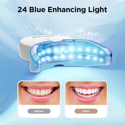 Teeth Whitening Kit with LED Light - 28 Whitening Strips for Sensitive Teeth, Rechargeable Whitening Case Included - BuzzMart